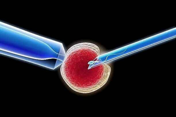 第一代“试管婴儿”的科普介绍